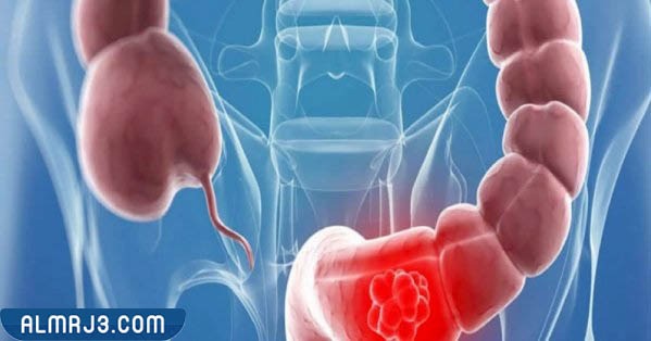 طرق تنظيف القولون جابر القحطاني