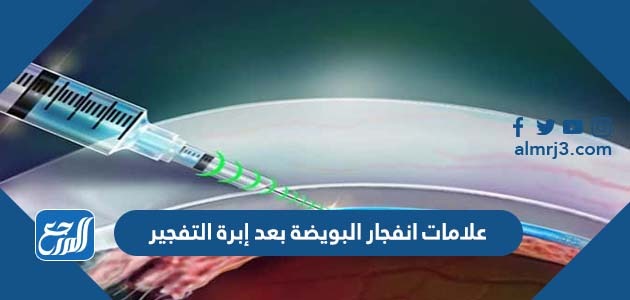 علامات انفجار البويضة بعد إبرة التفجير