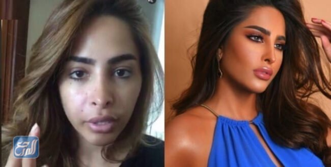 فوز الفهد قبل وبعد