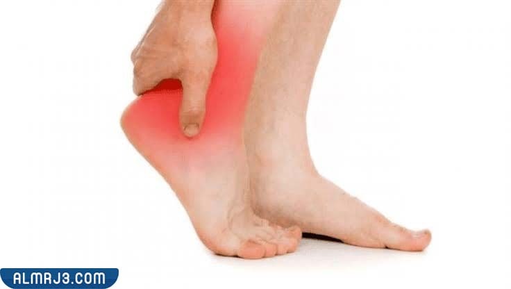ما هو تورم القدمين