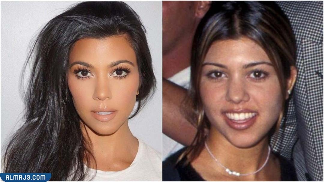 كورتني كارداشيان قبل وبعد