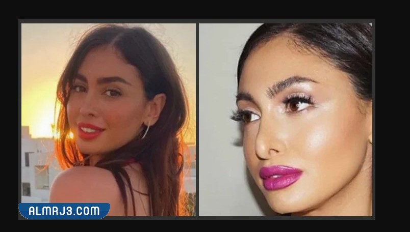 نيكول سعفان قبل وبعد التجميل