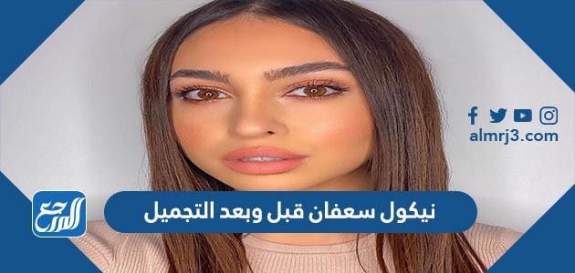 نيكول سعفان قبل وبعد التجميل