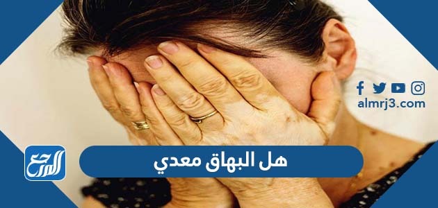 هل البهاق معدي