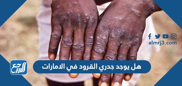 هل يوجد جدري القرود في الامارات