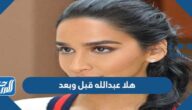 هلا عبدالله قبل وبعد
