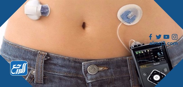 كم سعر مضخة الانسولين في السعودية