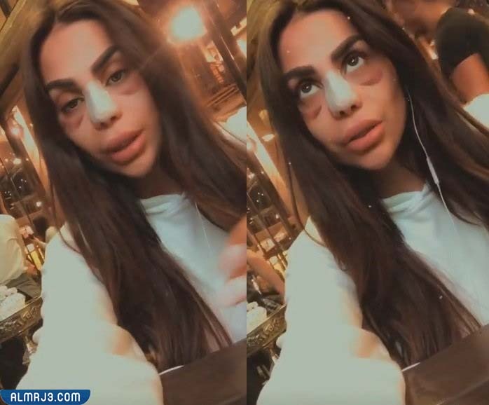 ميرنا طحان قبل وبعد