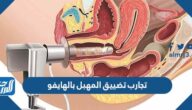 تجارب تضييق المهبل بالهايفو