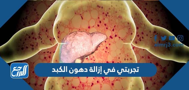 تجربتي في إزالة دهون الكبد