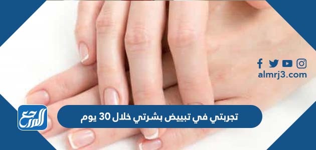 تجربتي في تبييض بشرتي خلال 30 يوم