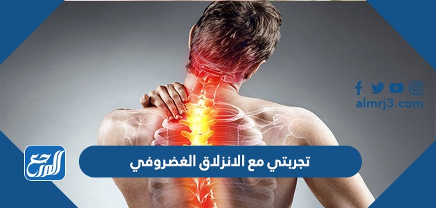 تجربتي مع الانزلاق الغضروفي