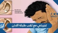 تجربتي مع ثقب طبلة الاذن والأعراض الناتجة عنها