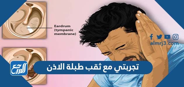 تجربتي مع ثقب طبلة الاذن