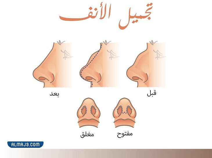 تجربتي مع جهاز تصغير الانف الوردي