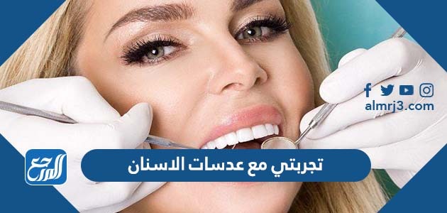 تجربتي مع عدسات الاسنان