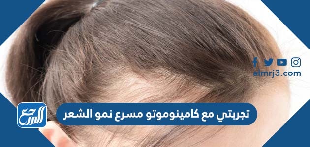 تجربتي مع كامينوموتو مسرع نمو الشعر