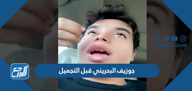 جوزيف البحريني قبل التجميل