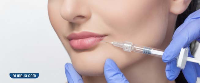 ما هو عدد جلسات حقن الفيلر للشفايف