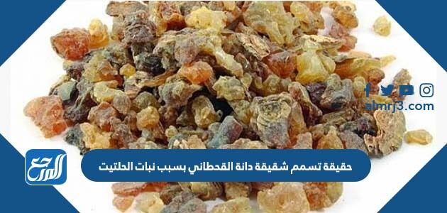 حقيقة تسمم شقيقة دانة القحطاني بسبب نبات الحلتيت