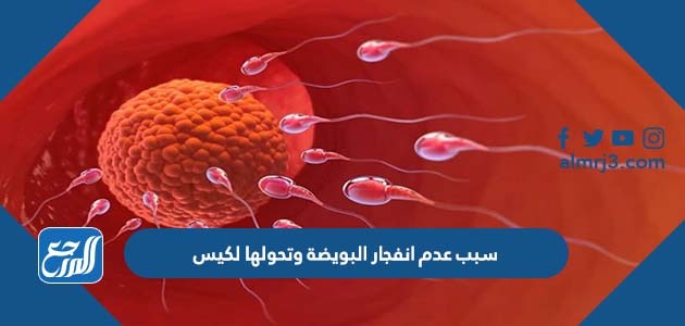 سبب عدم انفجار البويضة وتحولها لكيس