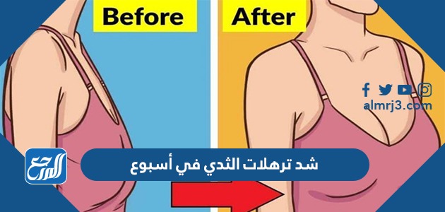 شد ترهلات الثدي في أسبوع