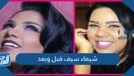 شيماء سيف قبل وبعد شيماء سيف قبل وبعد