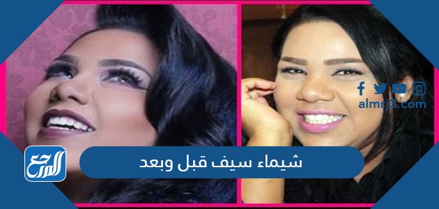شيماء سيف قبل وبعد