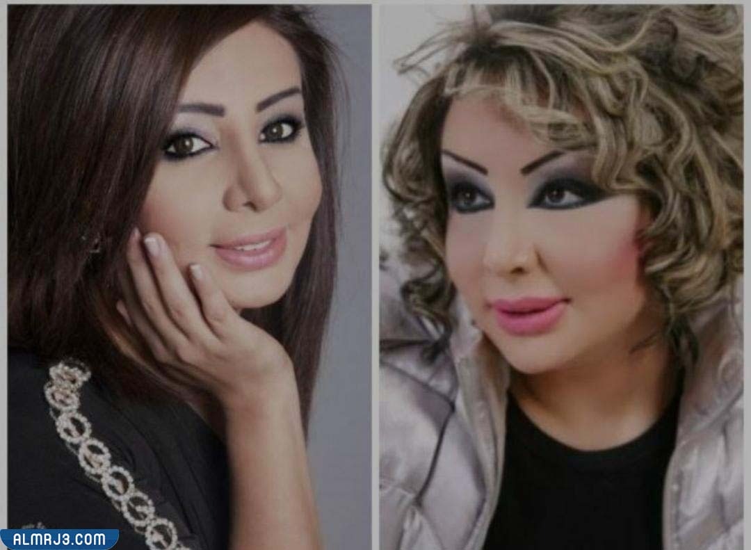شيماء علي قبل وبعد