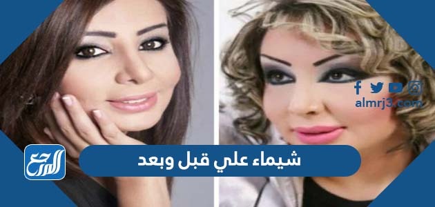شيماء علي قبل وبعد