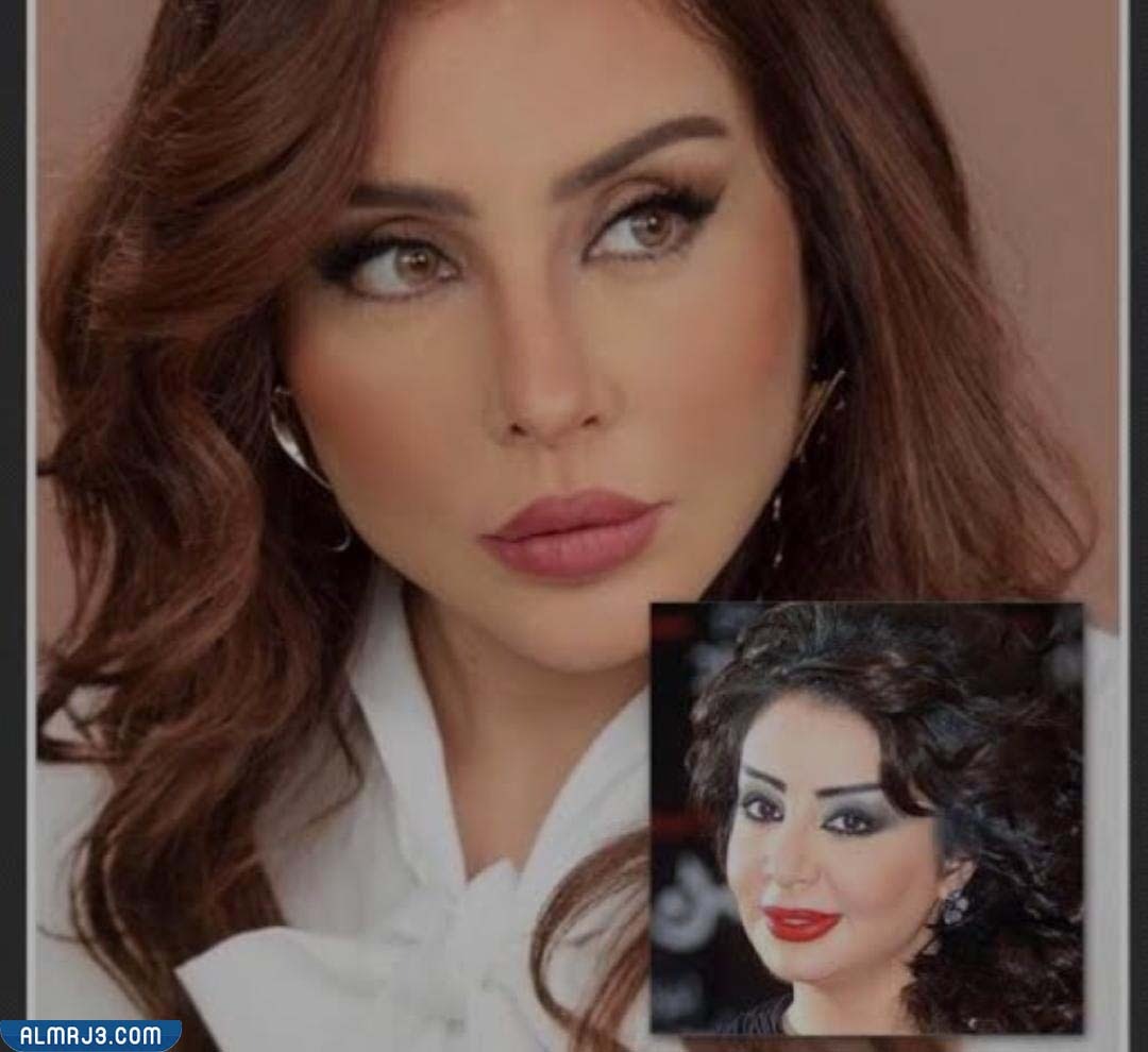 شيماء علي قبل وبعد