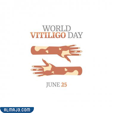 صور عن اليوم العالمي للبهاق 2022