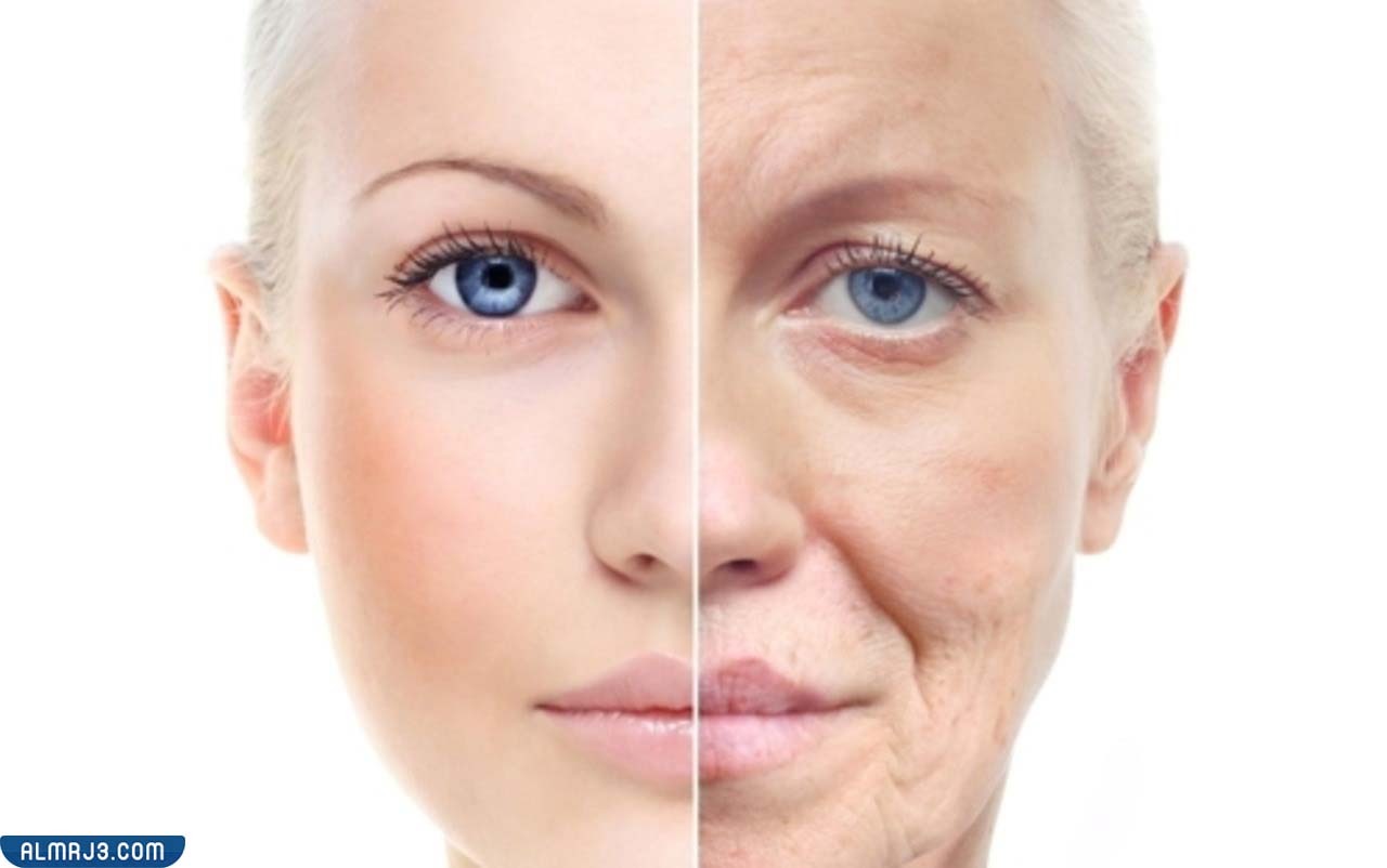 أضرار استخدام الفراكشنال ليزر