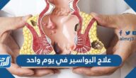 كيفية علاج البواسير في يوم واحد مجرب