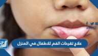 علاج تقرحات الفم للاطفال في المنزل