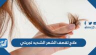 علاج تقصف الشعر الشديد تجربتي