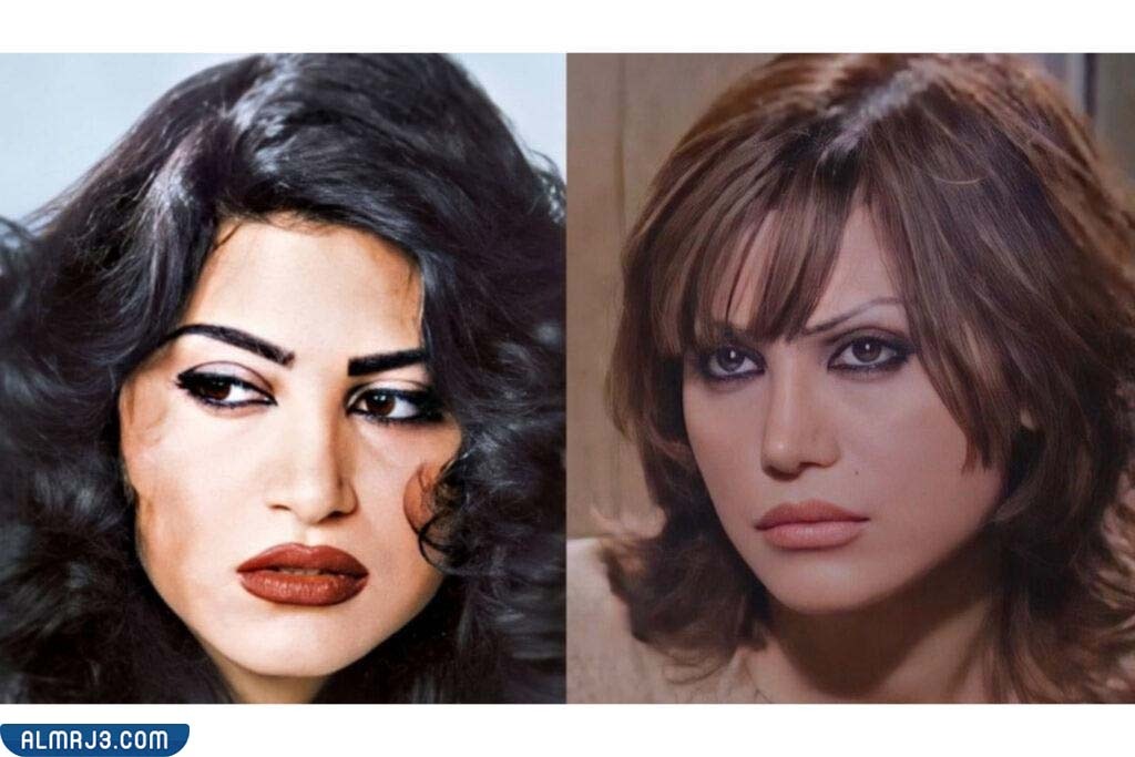 نورمان أسعد قبل وبعد الحادث