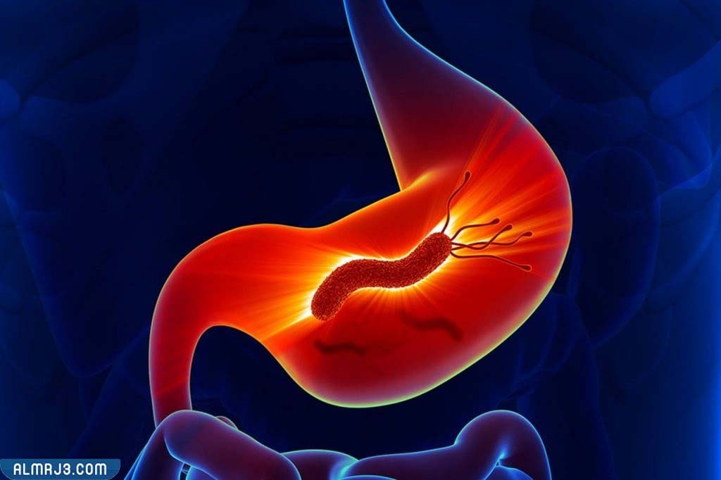 كم مدة استخدام علاج جرثومة المعدة؟