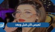 لميس كان قبل وبعد