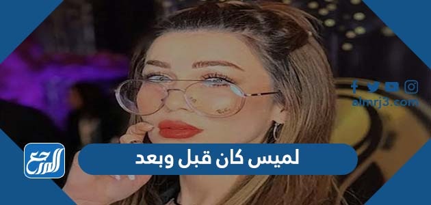 لميس كان قبل وبعد