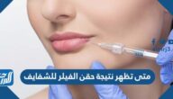 متى تظهر نتيجة حقن الفيلر للشفايف متى تظهر نتيجة حقن الفيلر للشفايف