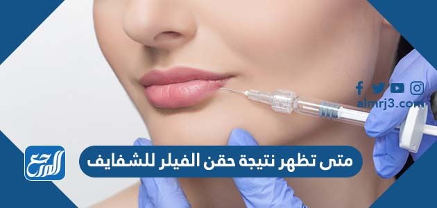 متى تظهر نتيجة حقن الفيلر للشفايف