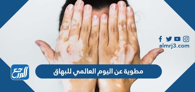 مطوية عن اليوم العالمي للبهاق