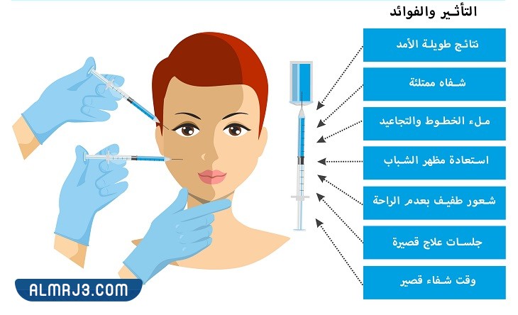 مميزات وعيوب إجراء حقن الفيلر بالرياض