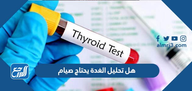 هل تحليل الغدة يحتاج صيام