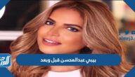 بيبي عبدالمحسن قبل وبعد