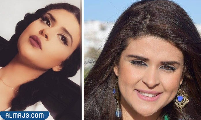 سلمى رشيد قبل وبعد