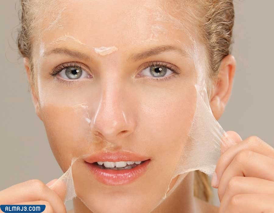 أسباب الحاجة إلى التقشير الكيميائي 