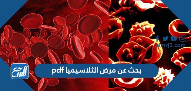 بحث عن مرض الثلاسيميا pdf