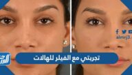 تجربتي مع الفيلر للهالات ومتى تظهر نتائجه